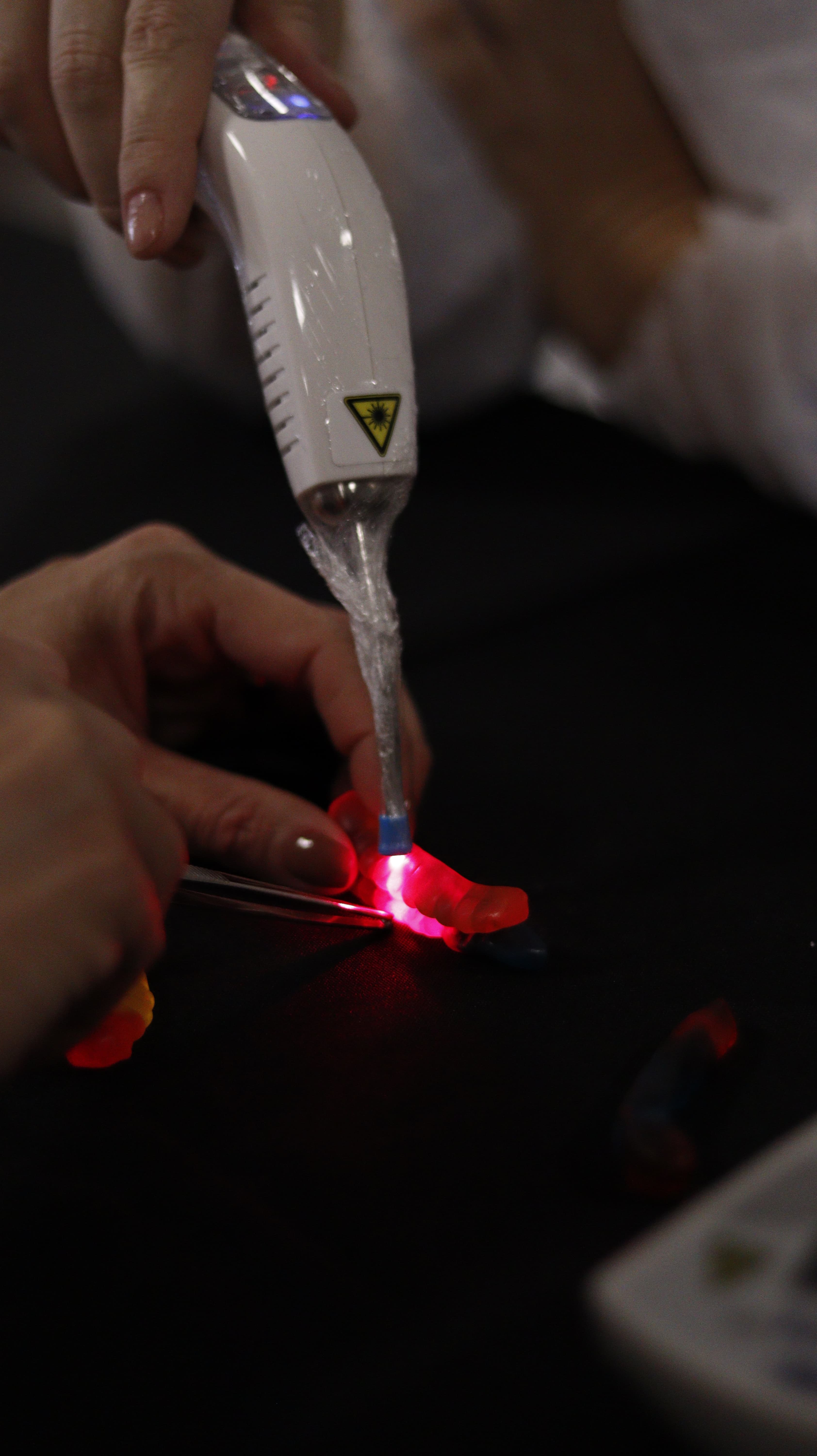 Hands-on com ozonioterapia